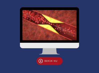 On demand webinar 'Klinische uitdagingen' bespreekt klinische uitdagingen bij de behandeling van VTE onder antistolling